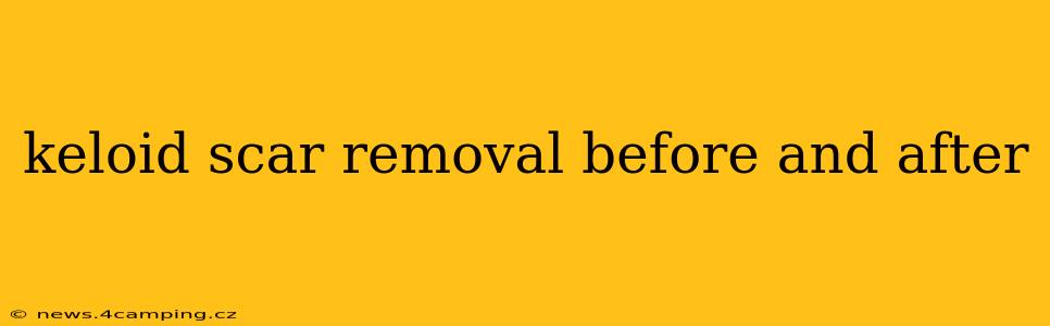 keloid scar removal before and after