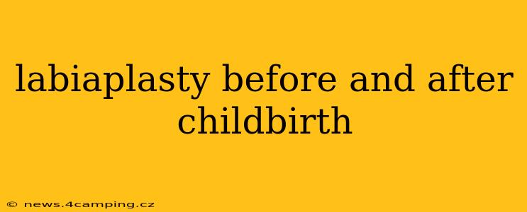 labiaplasty before and after childbirth