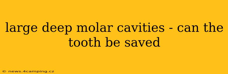 large deep molar cavities - can the tooth be saved