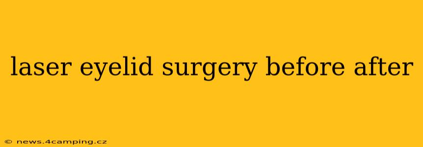 laser eyelid surgery before after