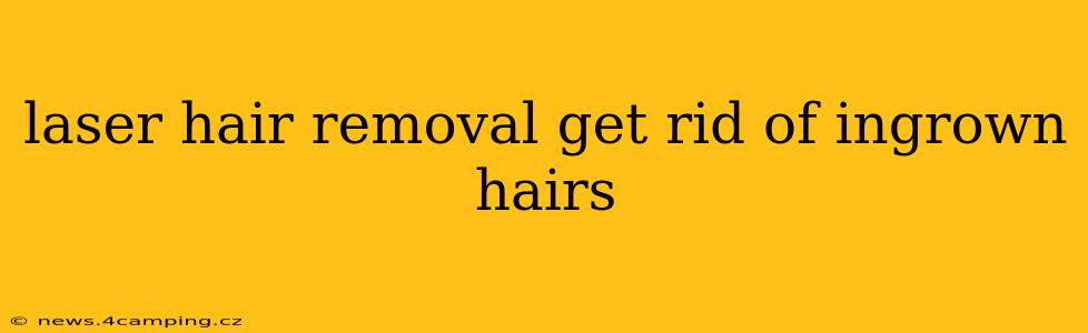 laser hair removal get rid of ingrown hairs