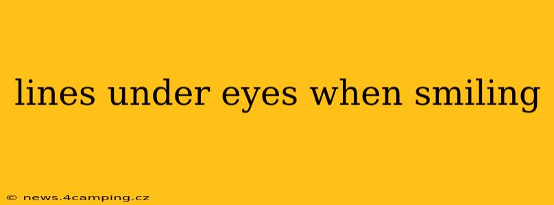 lines under eyes when smiling