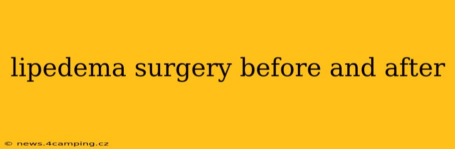 lipedema surgery before and after