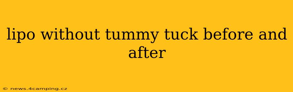 lipo without tummy tuck before and after