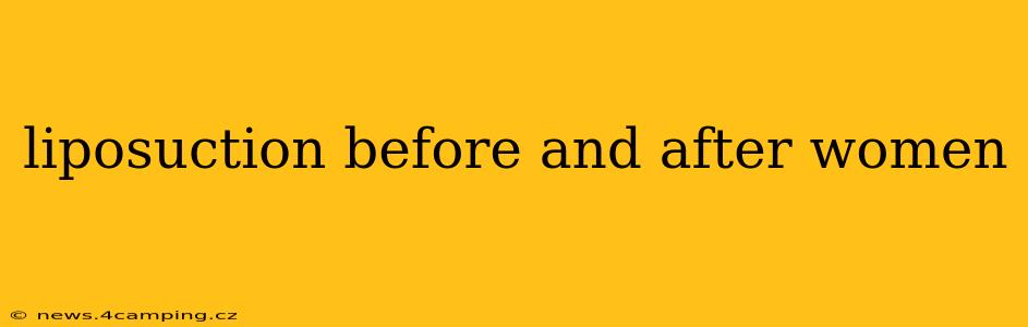 liposuction before and after women