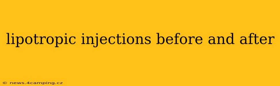 lipotropic injections before and after