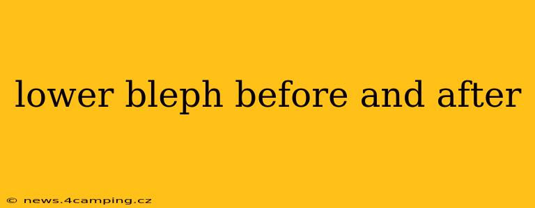 lower bleph before and after