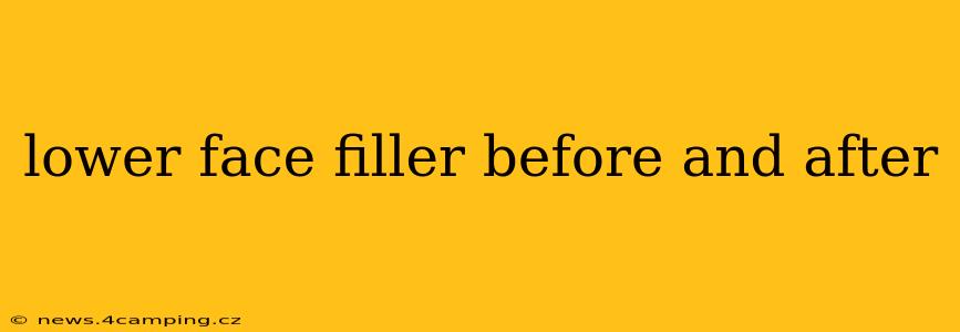 lower face filler before and after