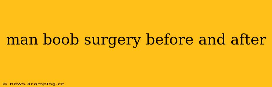 man boob surgery before and after