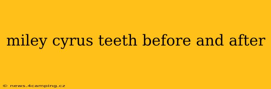 miley cyrus teeth before and after