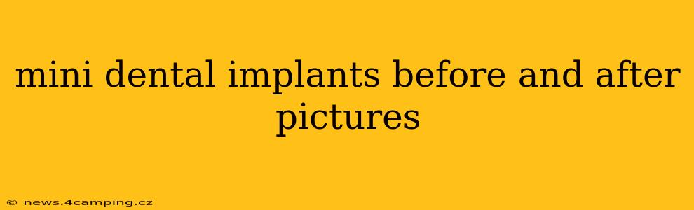 mini dental implants before and after pictures