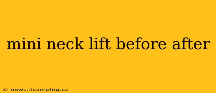 mini neck lift before after