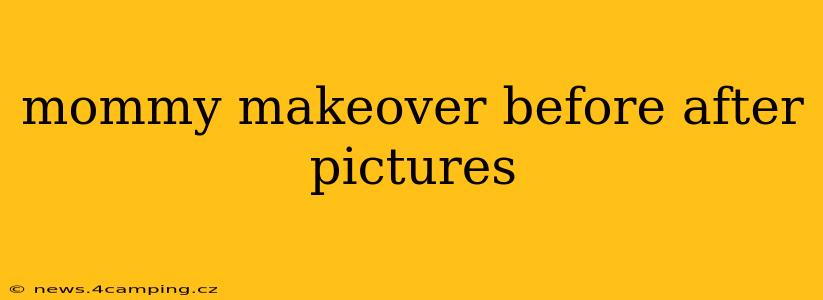 mommy makeover before after pictures