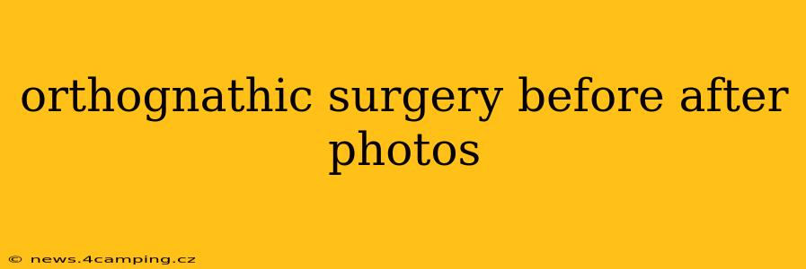 orthognathic surgery before after photos