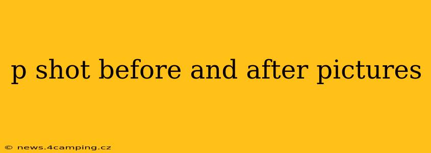 p shot before and after pictures