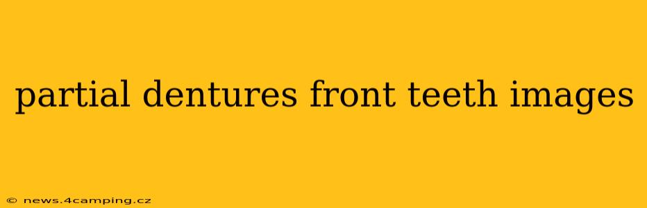 partial dentures front teeth images