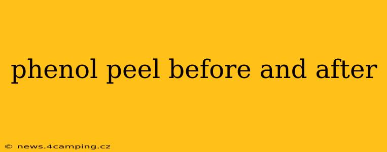 phenol peel before and after