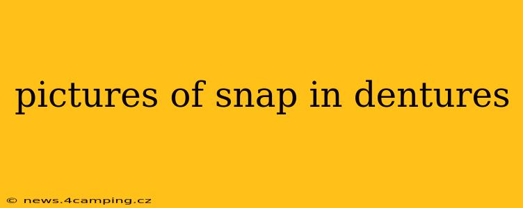 pictures of snap in dentures