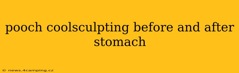 pooch coolsculpting before and after stomach
