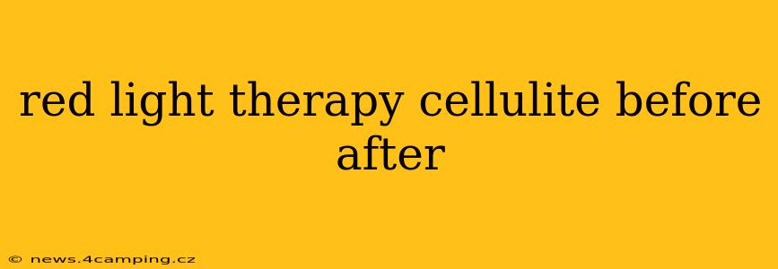 red light therapy cellulite before after