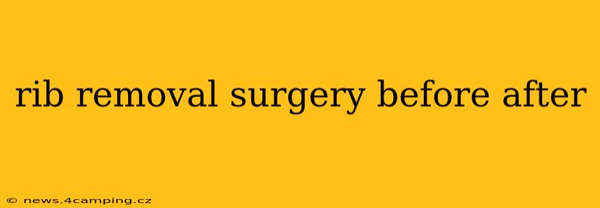 rib removal surgery before after