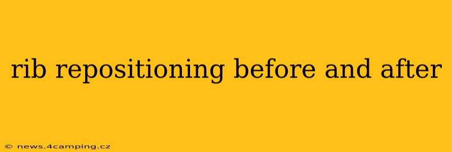 rib repositioning before and after