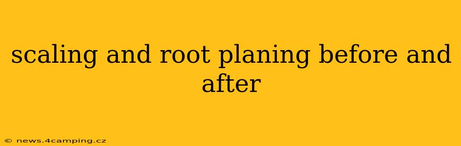 scaling and root planing before and after