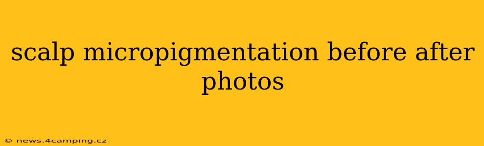 scalp micropigmentation before after photos