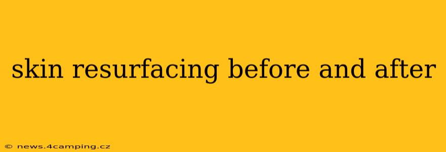 skin resurfacing before and after