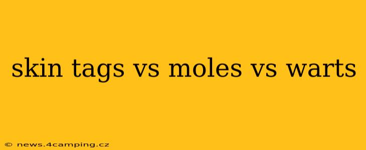 skin tags vs moles vs warts