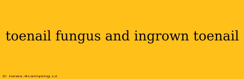 toenail fungus and ingrown toenail
