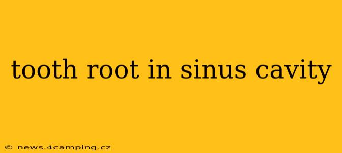 tooth root in sinus cavity
