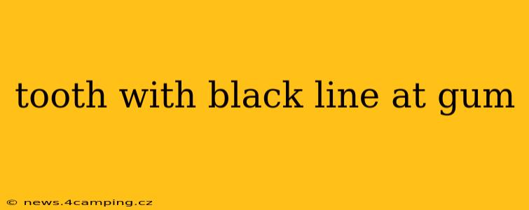 tooth with black line at gum