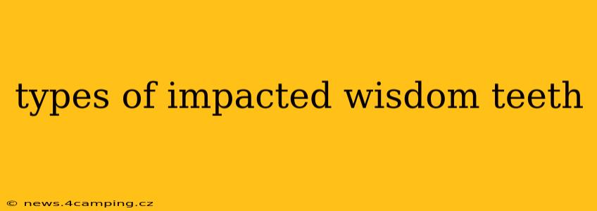 types of impacted wisdom teeth