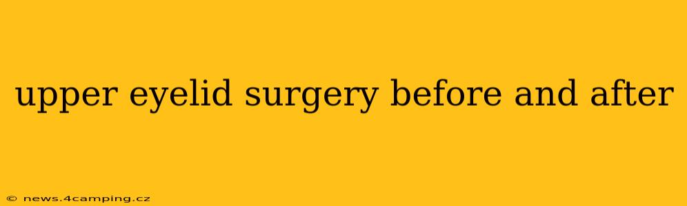 upper eyelid surgery before and after
