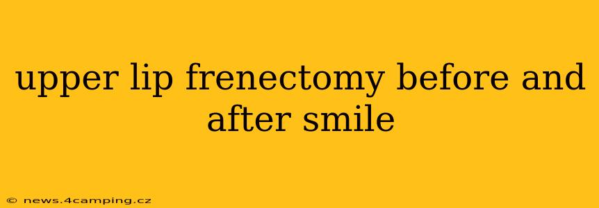 upper lip frenectomy before and after smile