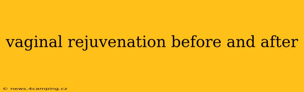 vaginal rejuvenation before and after