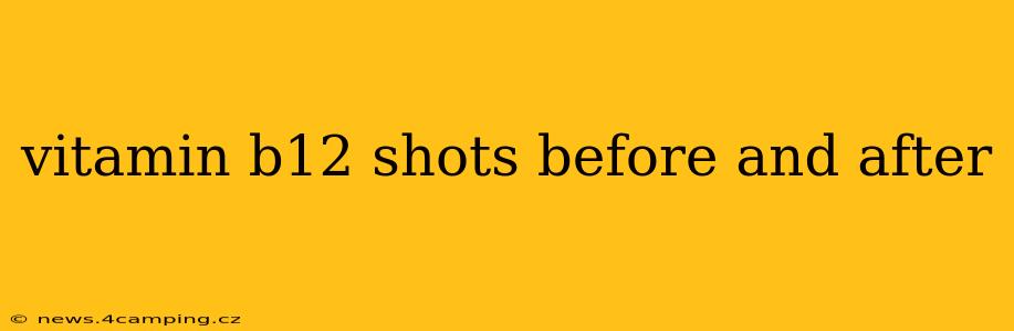 vitamin b12 shots before and after