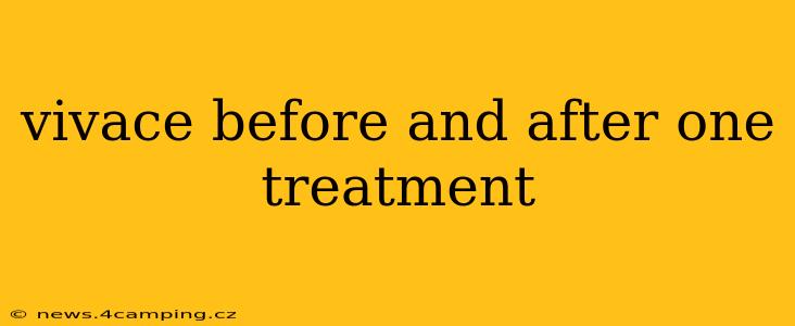 vivace before and after one treatment