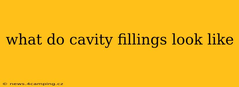 what do cavity fillings look like