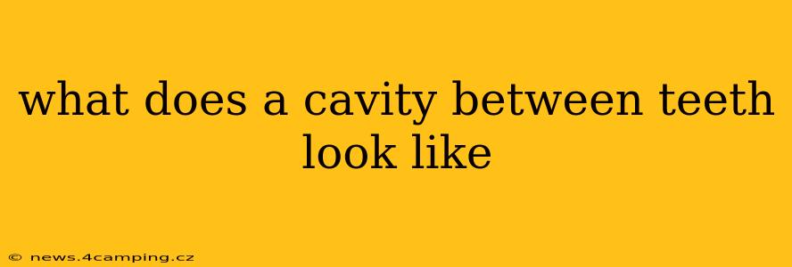 what does a cavity between teeth look like
