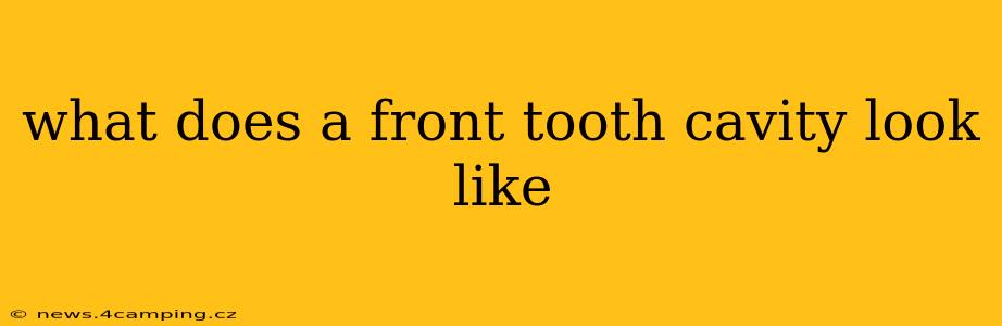 what does a front tooth cavity look like