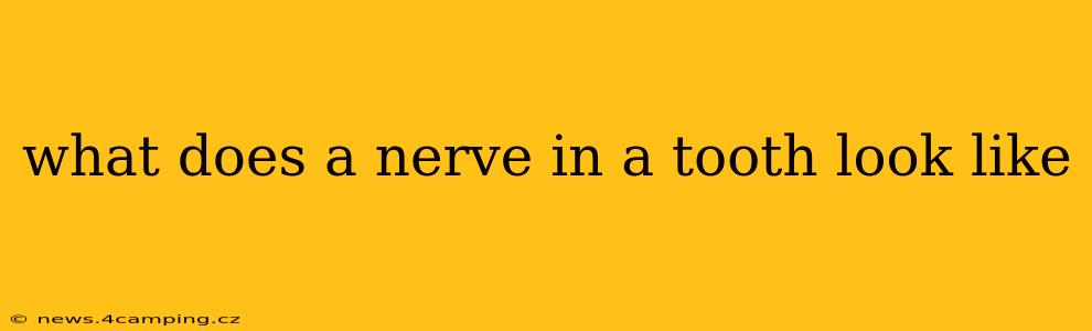 what does a nerve in a tooth look like