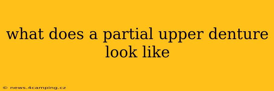 what does a partial upper denture look like