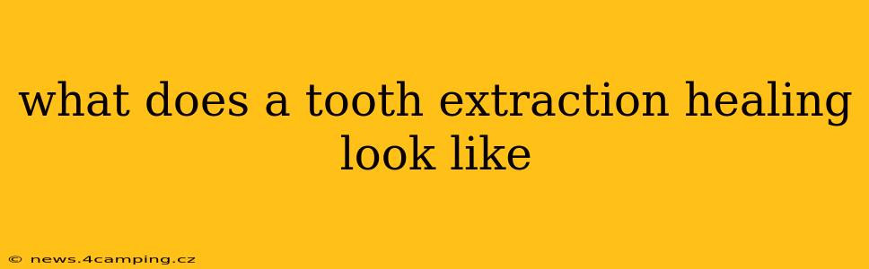 what does a tooth extraction healing look like