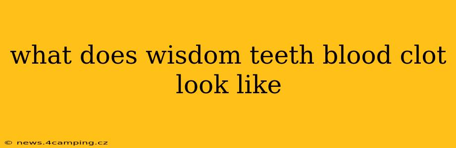 what does wisdom teeth blood clot look like