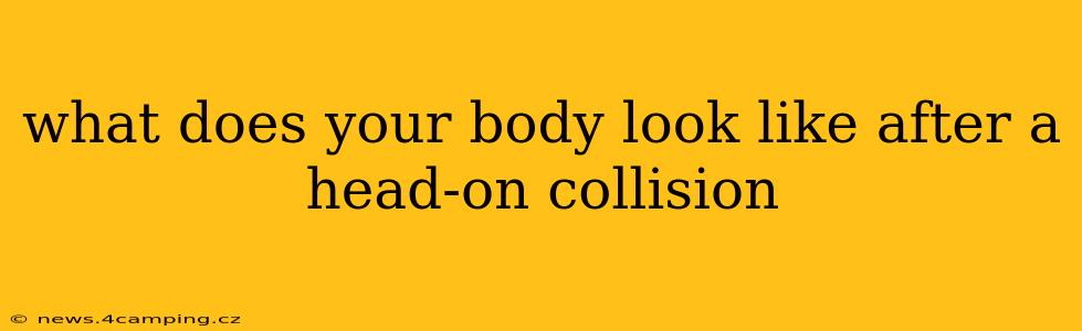 what does your body look like after a head-on collision