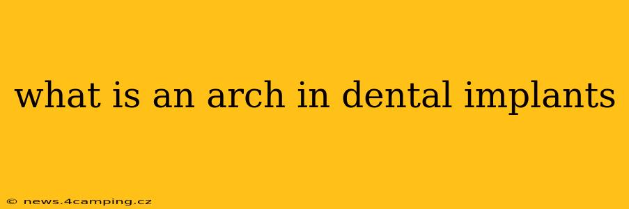 what is an arch in dental implants