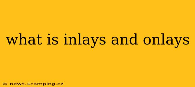 what is inlays and onlays