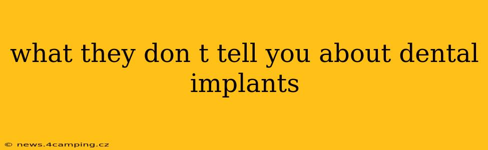 what they don t tell you about dental implants
